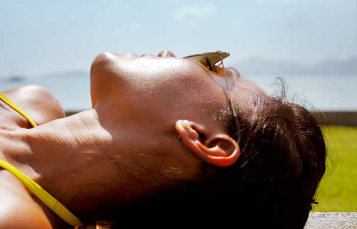 How to Get Rid of Sun Burn